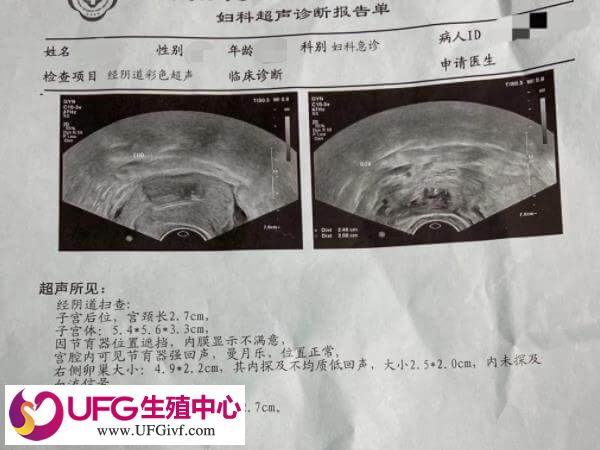 试管移植后按时产检