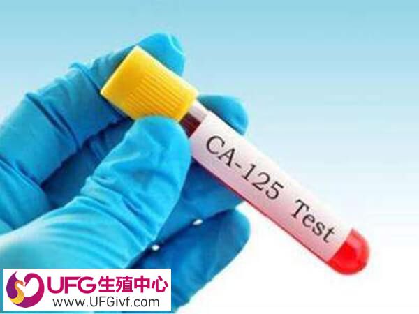 ca125是检查妇科肿瘤的
